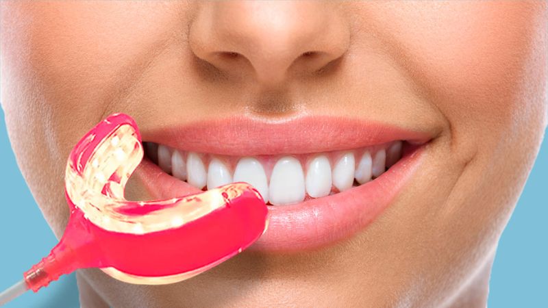 Product image of Nunawave Oral Care