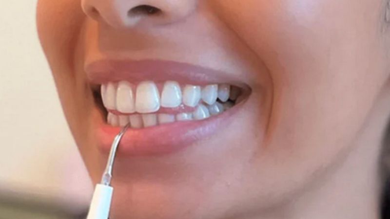 Product image of Sonic Glow Pick