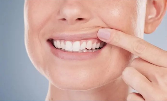 Product image of Purdentix