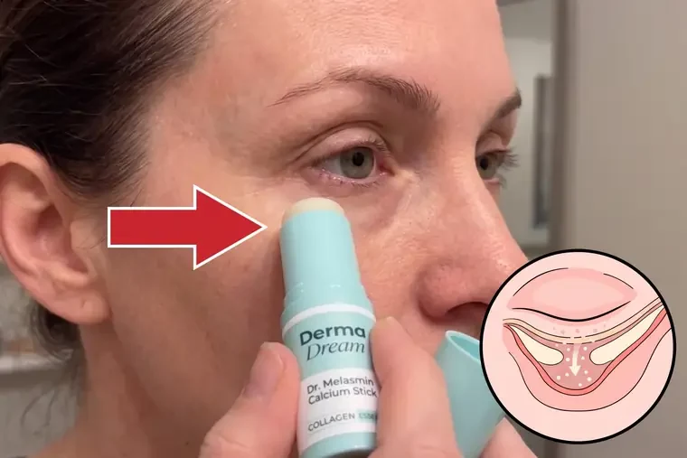 Product image of Dr. Melasmin