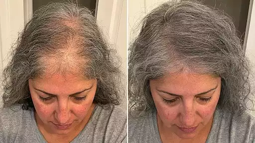 Product image of HaloGrow Hair Growth Spray